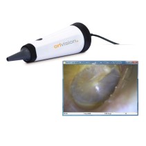 Otoscope vidéo USB ORLvision OX2