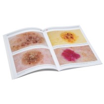 HEINE Compendium de dermoscopie