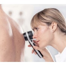 Dermatoscope HEINE DELTA 30 avec batterie Li-ion