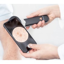 Dermatoscope HEINE DELTA 30 avec Coque d’adaptation pour Apple iPhone