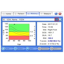 Appareil de mesure de la densité osseuse par ultrasons Inus S avec PC intégré