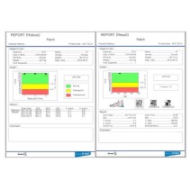 Appareil de mesure de la densité osseuse par ultrasons Inus S avec PC intégré